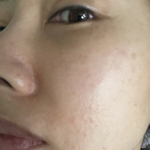 Hard water affected my skin and hair. Began developing solutions with Korean filtration experts.