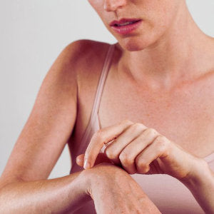 Skin barrier
