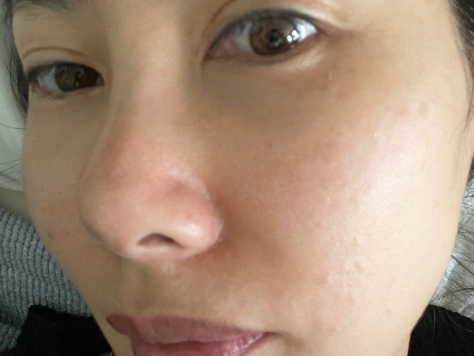 After